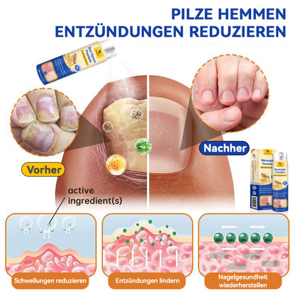 👏Furzero™ PsoriaHeal Bienengift Psoriasis Behandlungsspray(Geeignet für alle Hauttypen)