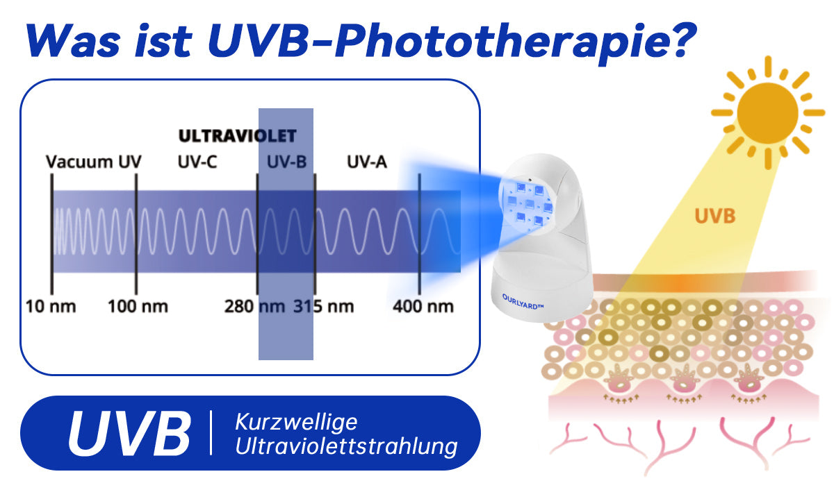 Ourlyard™ Psoriasis Rotierende UVB-Phototherapielampe (Freihändig, Geeignet für alle Hauttypen)