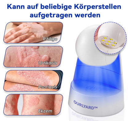 Ourlyard™ Psoriasis Rotierende UVB-Phototherapielampe (Freihändig, Geeignet für alle Hauttypen)