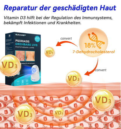 Ourlyard™ Psoriasis Rotierende UVB-Phototherapielampe (Freihändig, Geeignet für alle Hauttypen)